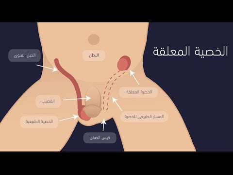 شكل الخصية المعلقة , تعرف على مضاعفات الخصية المعلقة